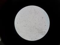 Human Sperm under a Microscope