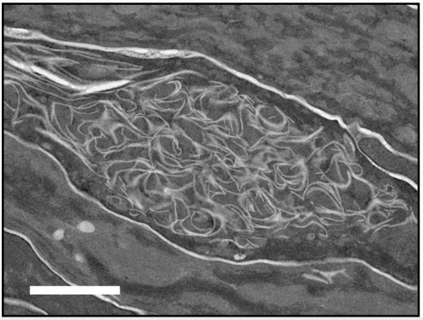 Abnormal Membrane Structure