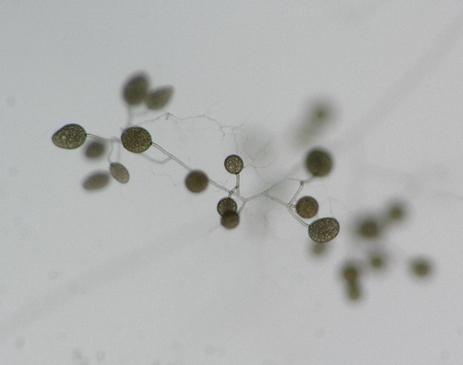 The Spores and Hyphae of 'Friendly' Arbuscular Mycorrhizal Fungi