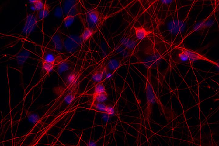 Neurons with a Mutation
