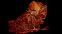 Ultramicroscope Creates High-Resolution 3-D Pictures of Flies