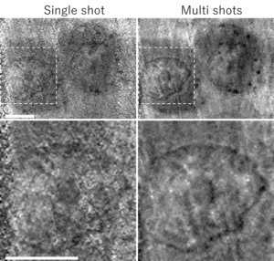 Soft X-ray images of cells.