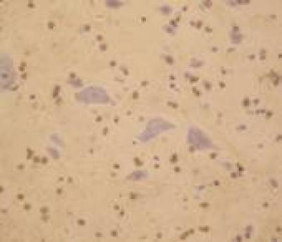 L4-6, Propofol Treatment