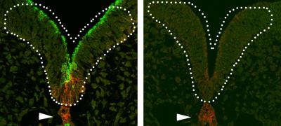 Development of the Forebrain