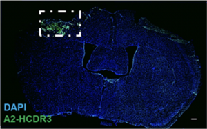 Biomarker prospecting to better understand traumatic brain injury (TBI)