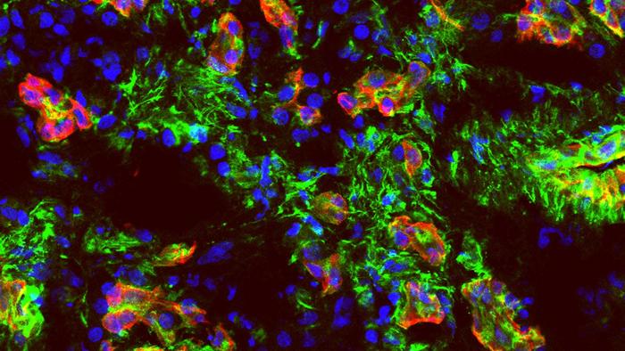 pancreatic cancer cells