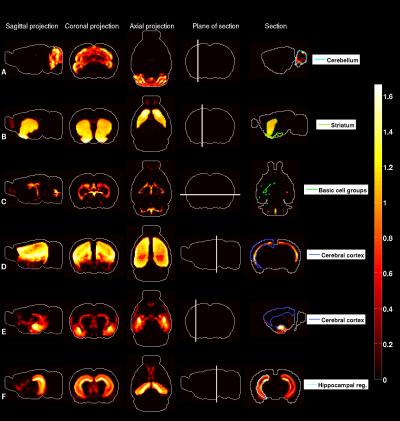 'Heat Maps' of the Brain