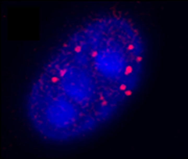 Mutant Huntingtin Forms Foci in Skeletal Muscle