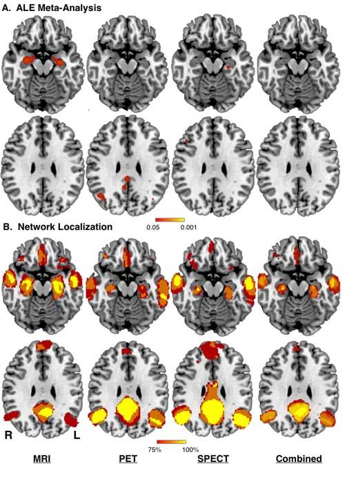 A Mapping Technique to Reassess Prior Alzheimer's Studies Finds Improved Reproducibility