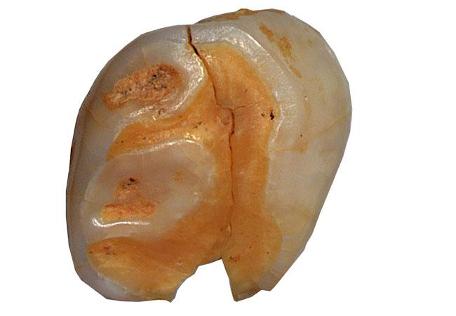 Neanderthal milk tooth