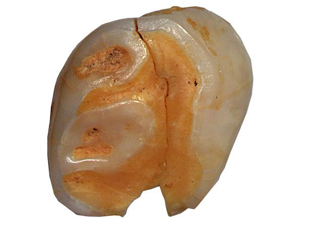 Neanderthal Milk Tooth