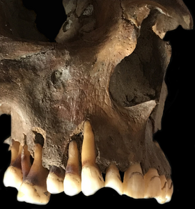 Teeth and skull of a young adult male from 17th century Holland