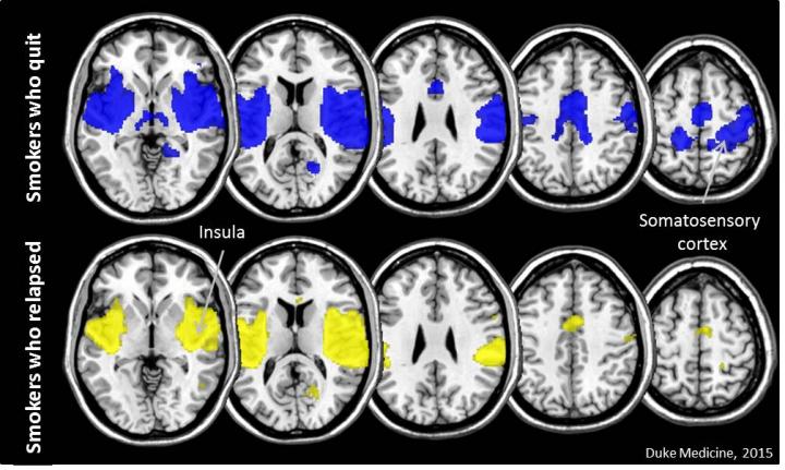 Brain Connectivity in Smokers