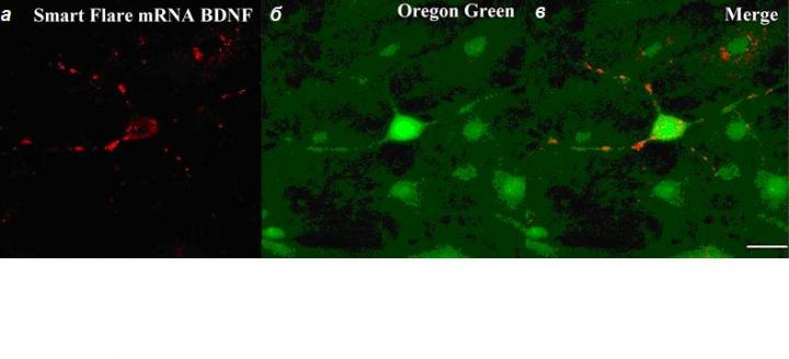 The Use of mRNA Probes in Combination with Calcium-sensitive Dye Oregon green 488 BAPTA-1