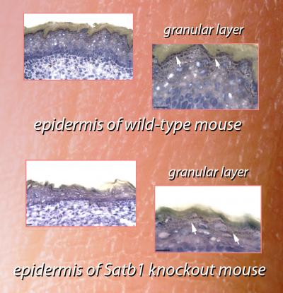 Thick Skin and Thin Skin