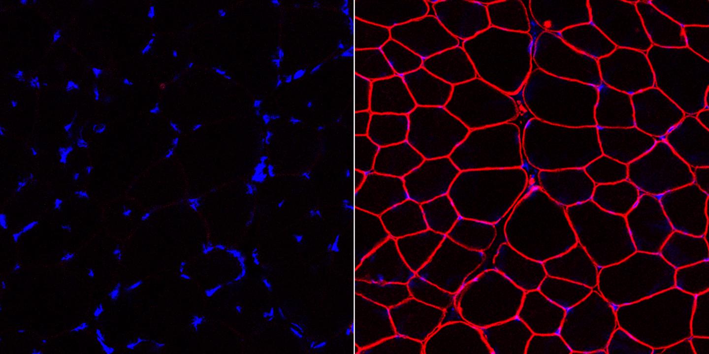 An Efficient Strategy to Edit Common Mutation that Causes Duchenne Muscular Dystrophy (5 of 5)