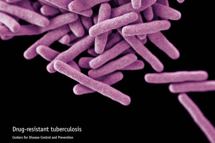 Drug-Resistant Mycobacterium Tuberculosis