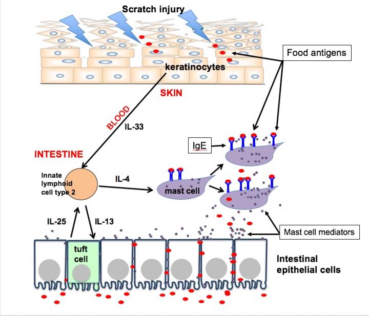 Scratching and Mast Cells