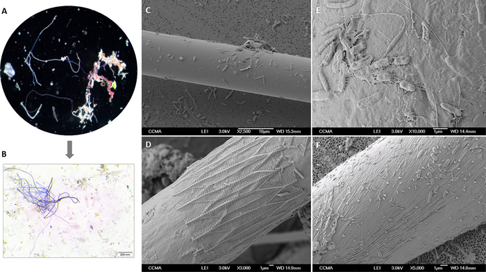 Vibrio spp and other potential pathogenic bacteria associated to microfibers in the North-Western Mediterranean Sea