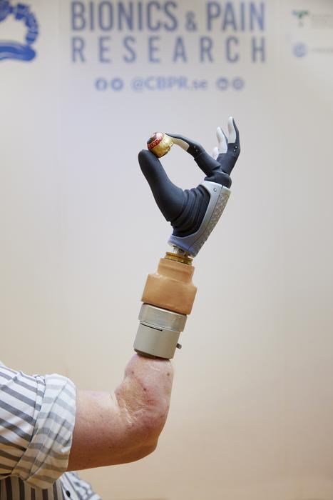 Neuromusculoskeletal hand prosthesis