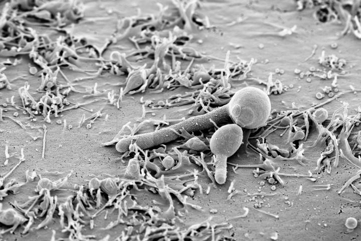 Fungus <i>Candida Albicans</i>