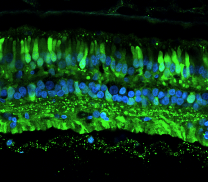 AAV-infected cells in the retina