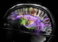 DSI Image of a Whole Human Brain