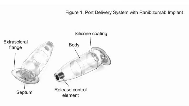 Port Delivery System