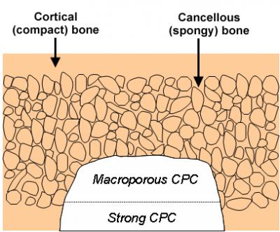 Layered Approach May Yield Stronger, More Successful Bone Implants 2 (of 2)