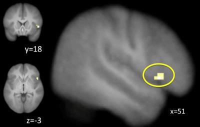 Brain Activation during Training