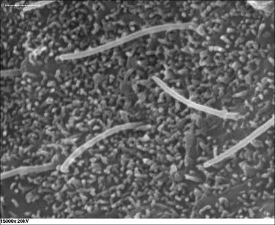 Critical Protein Discovered for Healthy Cell Growth in Mammals