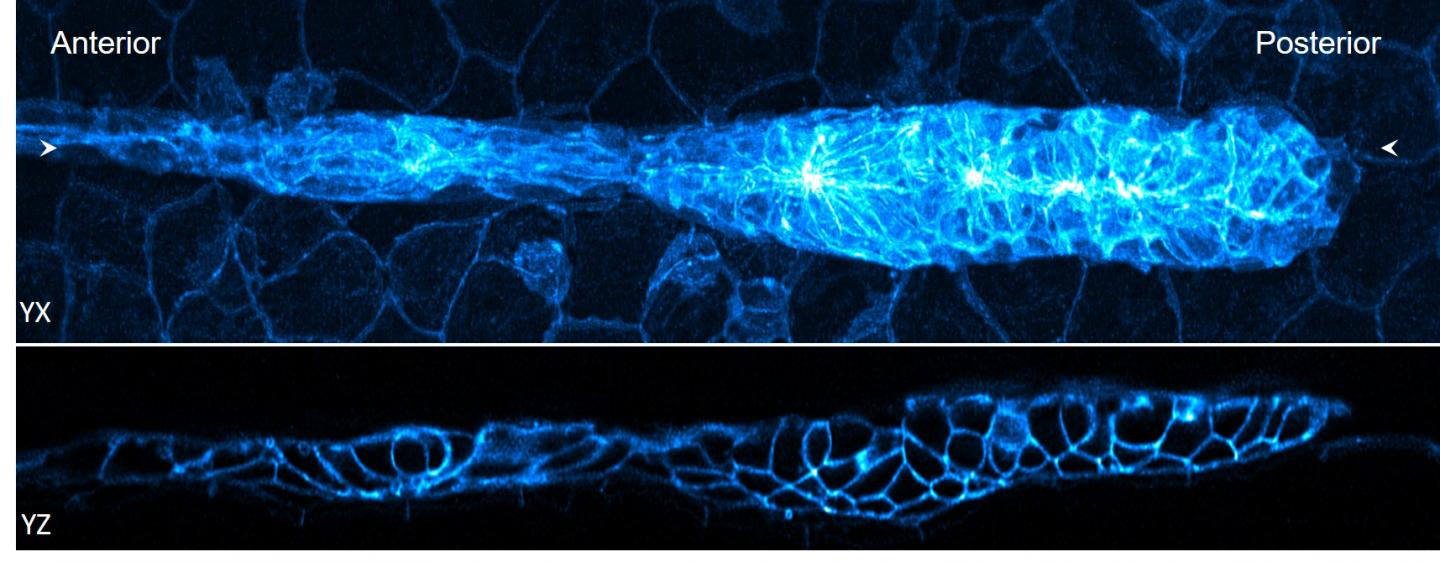 32-hour zebrafish embryo