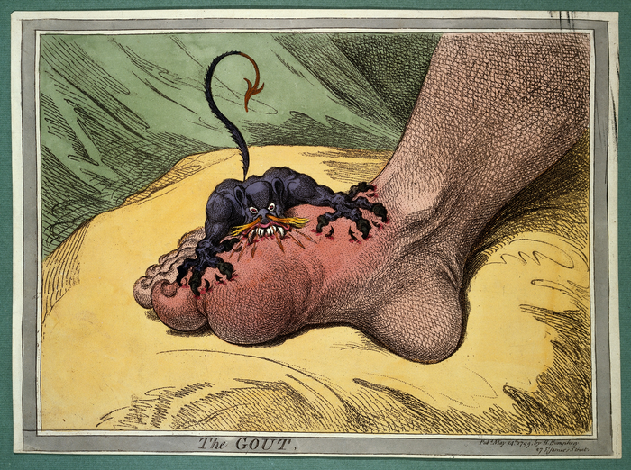 Gillray's gout illustration