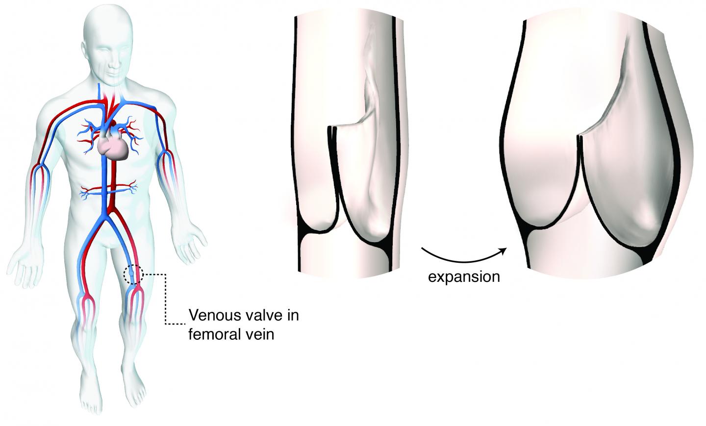 Size-Adjustable Prosthetic Heart Valve Accommodates Heart Growth in Sheep (3 of 8)