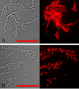 microscope images of E. coli exposed to antibacterial protein