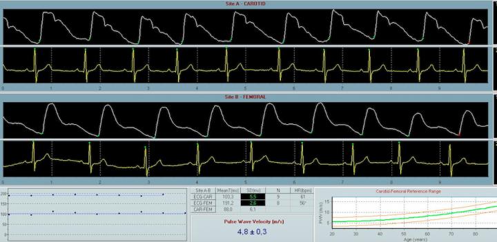 Screenshot of CF-RWV Measurement