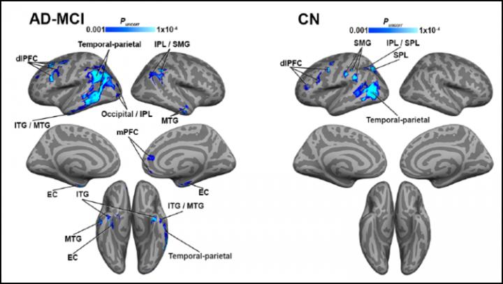 Brain Regions with Impaired Blood Flow Have Higher Tau Levels