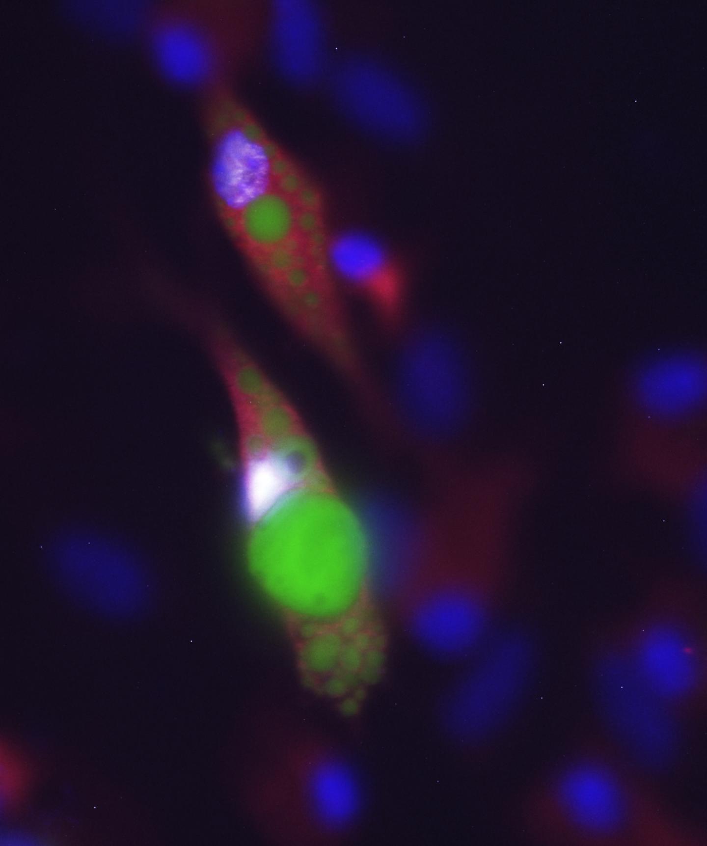 Dab2-positive Pre-adipocytes