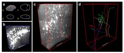 Micron-Scale Neuroanatomy of a Whole Mouse Brain