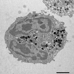 Electron microscopy image of a blood cell