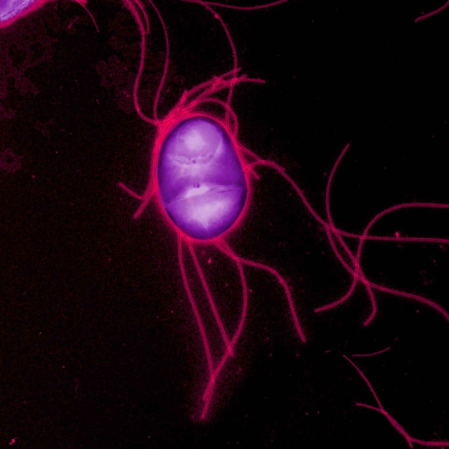 <em>Salmonella</em> Typhimurium 