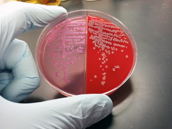 E.coli in laboratory growth media