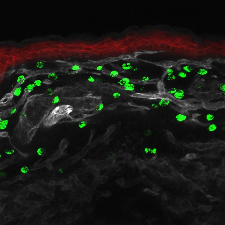 Confocal Imaging of the Skin of a New-Born Mouse