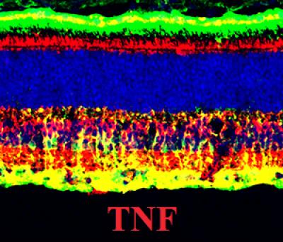 Cell Death Pathway in the Retina