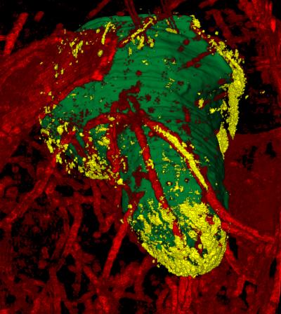 Seeing Cancer Cells Migrate