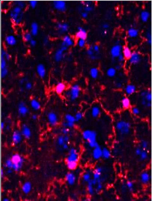 Healthy Microglia (Red) in Mouse Brain