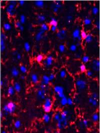 Healthy Microglia (Red) in Mouse Brain