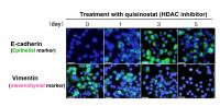 Reverse-Transition to Epithelial Characteristics