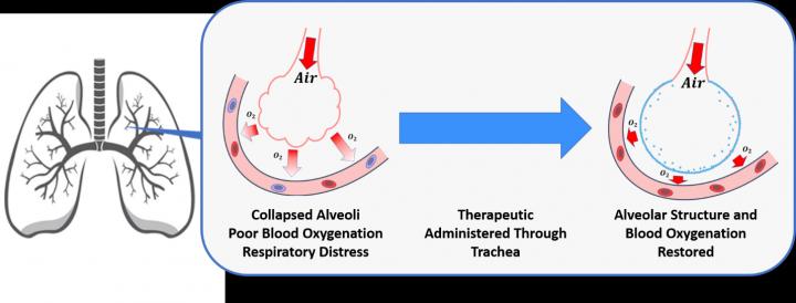 Collapsed Alveoli Causes Poor Blood Oxygenation, Respiratory Distress