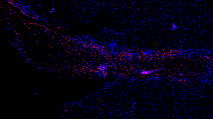 Study Reveals Ebola Virus Can Hide in Brain, Persist Even Years After Treatment